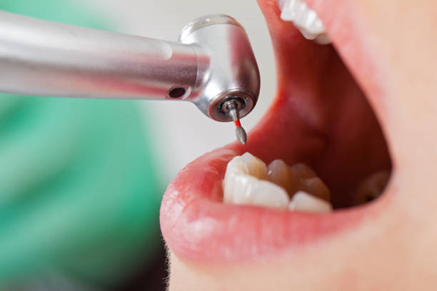Best Emergency Broken Tooth Repair in Pipestone, MN
